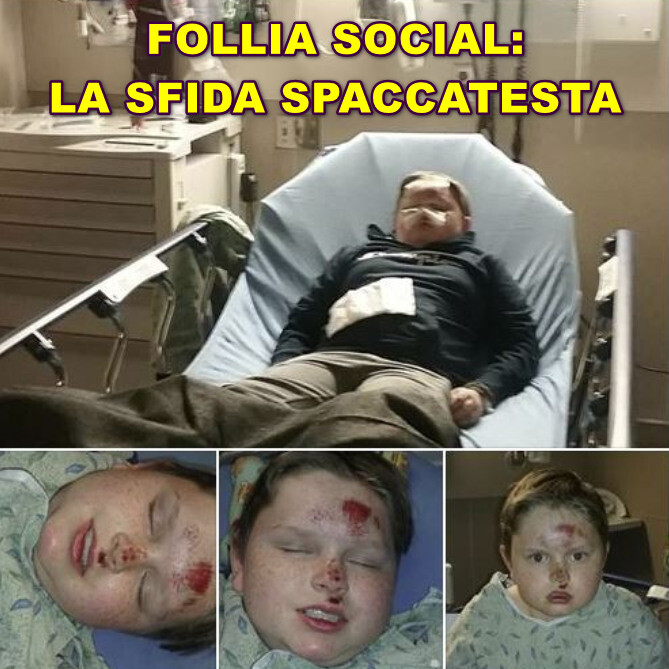 follia social Skullbreaker Challenge, l’ultima follia social è un tranello spacca-testa – Calci nell’ano, visi sfregiati. Si può morire